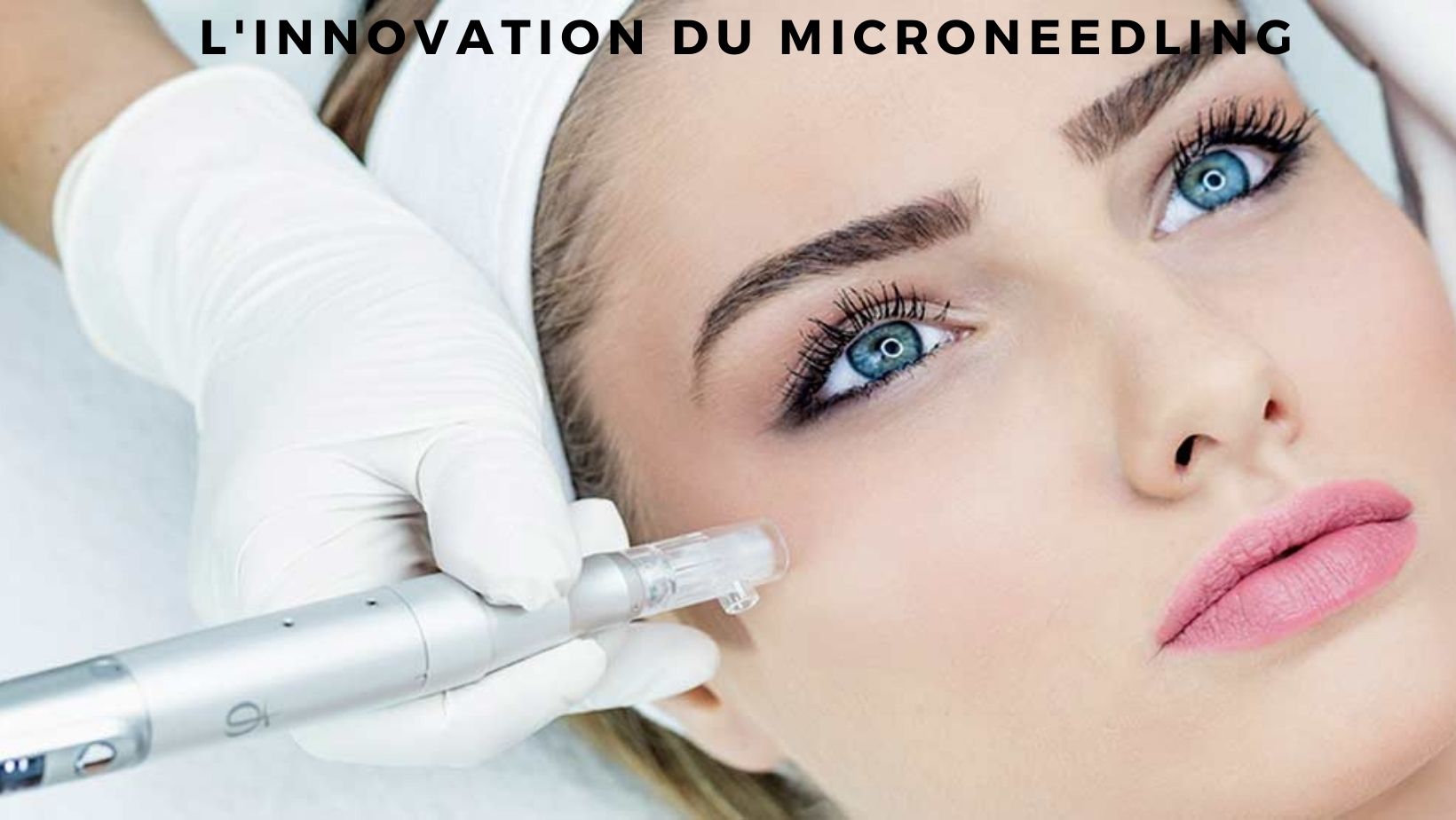 Microneedling Linnovation étonnante Dans Le Monde Cosmétique